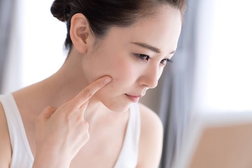 頬に手を当てる女性